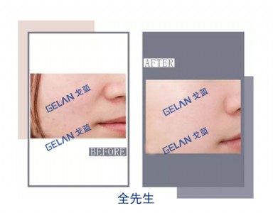 t(y)ĤNӹN Vݸ{(ln)